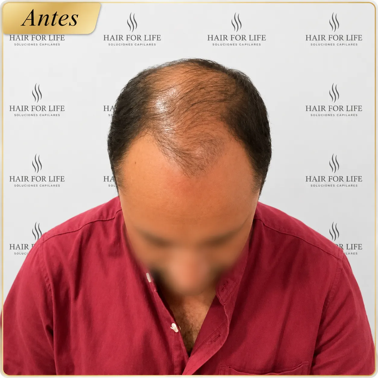 Caso 1 Antes