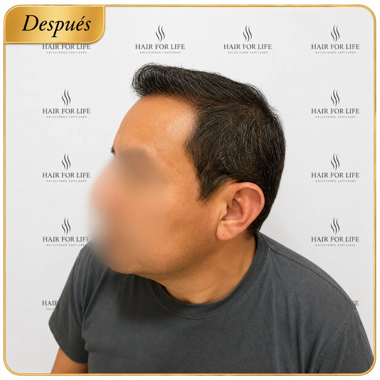 Caso 3 Después